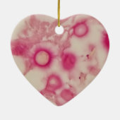 Ornement cryptococcal (Dos)