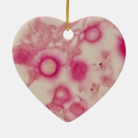 Ornement cryptococcal (Dos)