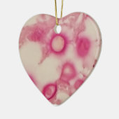 Ornement cryptococcal (Gauche)