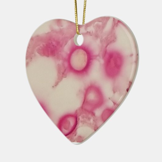 Ornement cryptococcal (Gauche)