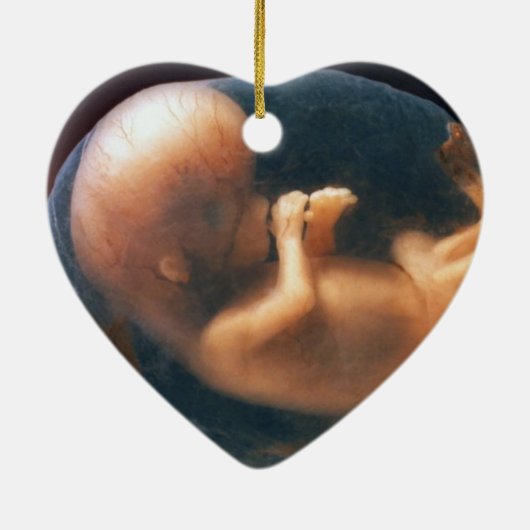 ORNEMENT EN CÉRAMIQUE CRUSADER ANTI-AVORTEMENT (Dos)