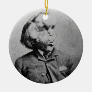 Ornement En Céramique Joseph "John" Merrick The Elephant Man from 1889