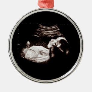 Ornement En Métal Bébé Grossesse Noël Ultrasons Photo Classy