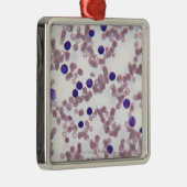 Ornement En Métal Cellules néo-plastiques de lymphocyte (Droite)