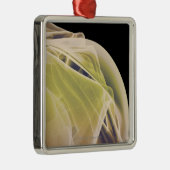 Ornement En Métal Muscles de l'épaule (Droite)