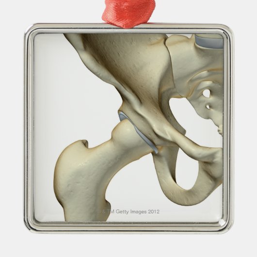 Ornement En Métal Os de la hanche 5 (Devant)