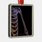 Ornement En Métal Os de l'épaule (Droite)