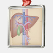 Ornement En Métal Procédure de greffe de foie (Gauche)
