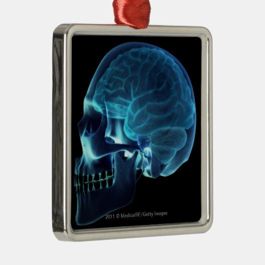 Ornement En Métal Rayon X du cerveau à l'intérieur d'un crâne (Droite)