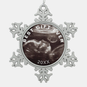 Ornement Flocon De Neige Photo Ultrasound personnalisée Meilleur cadeau de