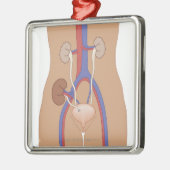 Ornement Métallique Greffe de rein (Gauche)
