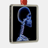 Ornement Métallique Rayon X des os dans le cou (Droite)