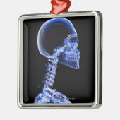 Ornement Métallique Rayon X des os dans le cou (Gauche)
