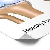 Osteoartritis van kniegewrichten Poster (Hoek)