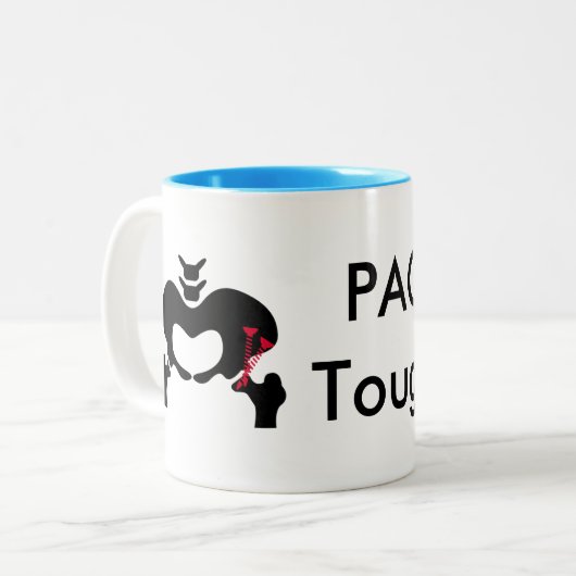 Osteotomy Peri-acétabulaire classique de tasse de (Devant gauche)