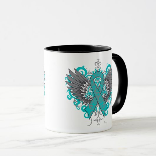 Ovariumcarcinoom Mok (Voorkant rechts)