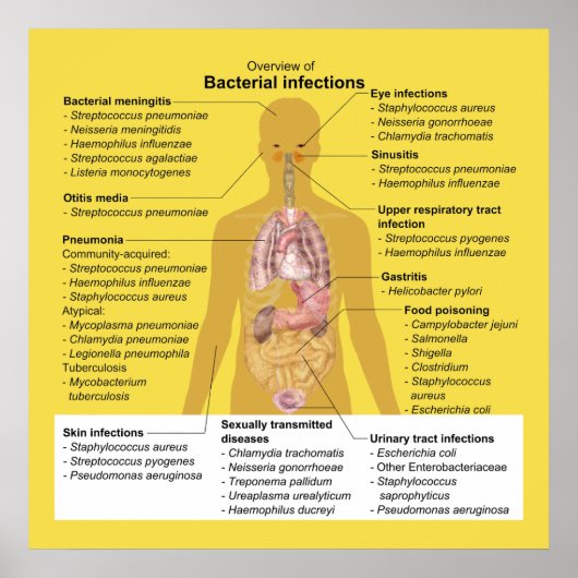 Overzicht van bacteriële infecties (Voorkant)
