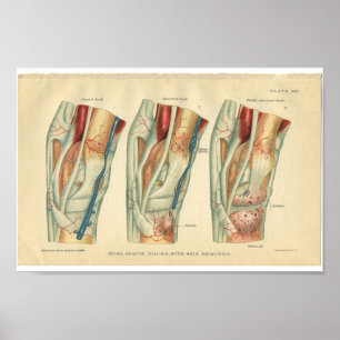 paardenanatomie Afdruk been Poster