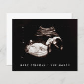 Papier Budget Grossesse Bébé Sonogramme Ultrasons Photo (Devant / Derrière)