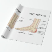 Papier Cadeau La difformité de Haglund (Déroulé)