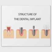 Papier Cadeau Structure de l'implant dentaire (Plat)