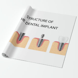 Papier Cadeau Structure de l'implant dentaire