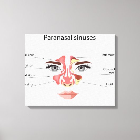 Paranasale sinussen canvas afdruk (Voorkant)