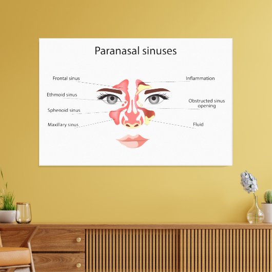 Paranasale sinussen canvas afdruk (Insitu (Woonkamer))