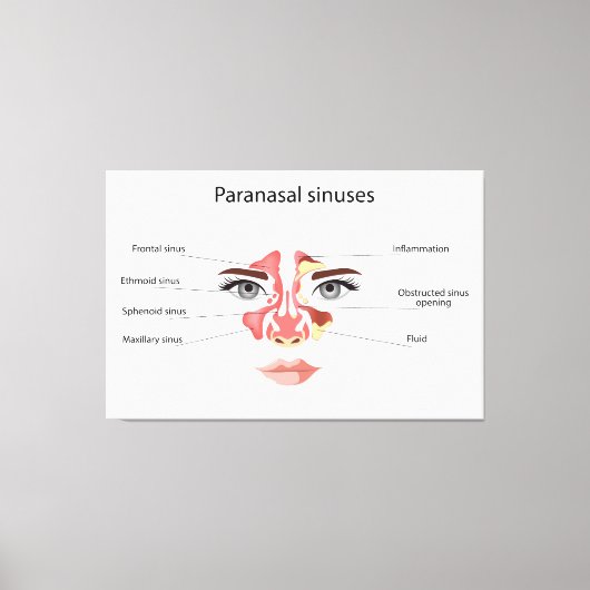 Paranasale sinussen canvas afdruk (Voorkant)