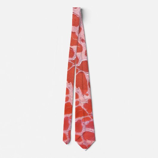 pathologie de l'hémangiome de cravate (Dos)