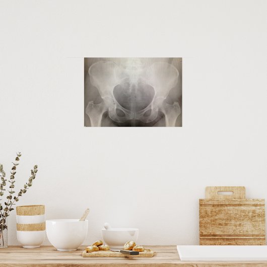 Pelvis X-ray Poster (Keuken)
