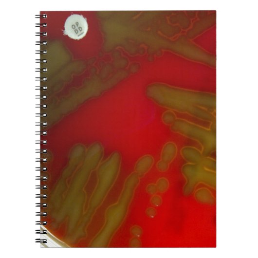 Penumonia Bacteria Notitieboek (Voorkant)