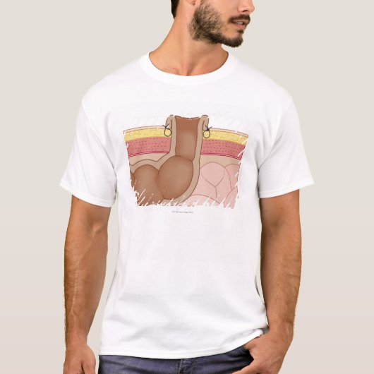 Permanent Colostomy T-shirt (Voorkant)