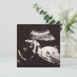 Persoonlijk Ultrasound Afbeelding Baby shower Kaart