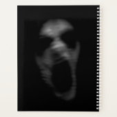 Pertes de troubles mentaux (Dos)