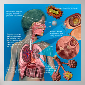 Pertussis (Whooping hoest) poster