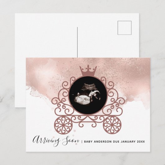 Petite princesse Sonogramme Faire-part de grossess (Devant / Derrière)