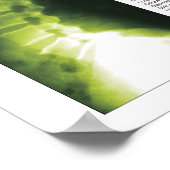 Phases Lombaire Cervical Poster de dégénérescence (Coin)