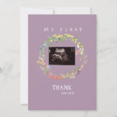 Photo d'échographie de fille Merci bébé Point de v (Devant)