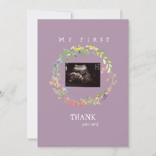 Photo d'échographie de fille Merci bébé Point de v