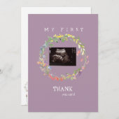 Photo d'échographie de fille Merci bébé Point de v (Devant / Derrière)