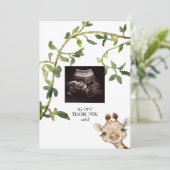 Photo échographie girafe Merci  (Debout devant)