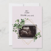 Photo échographie rose Merci bébé Point de vue (Devant)