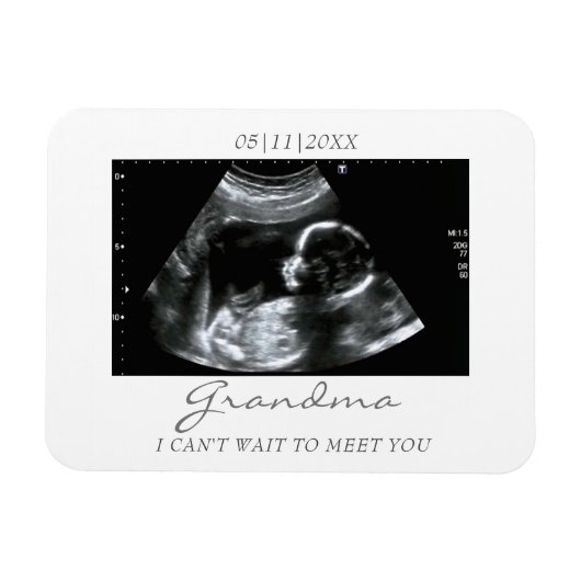 Photo Magnet Ultrasound Cadeaux pour grand-mère So (Horizontal)