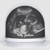 Photo sur mesure de la grossesse de Sonogramme (Avant)