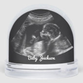 Photo sur mesure de la grossesse de Sonogramme (Arrière)