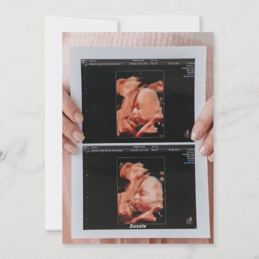 Photo Ultrasound Noël Faire-part de grossesse (Dos)