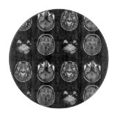 Planche À Découper Analyse IRM du cerveau (Devant)