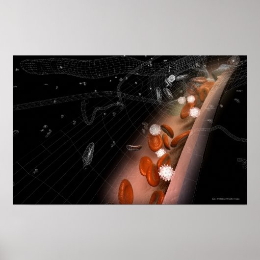 Plaque in de slagaders poster (Voorkant)