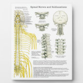 Plaque Photo Chiropratique Nerves spinales Subluxations Easel (Devant)